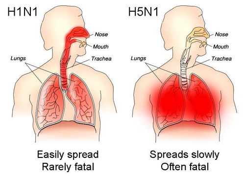 澳大利亚官方证实首次H5N1型禽流感病例，将对全球公共卫生带来影响