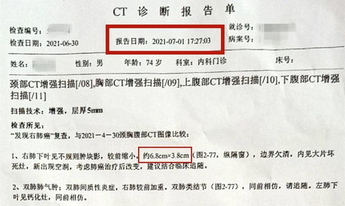 网络检索+医疗解读：深入解析肺部CT报告的14个关键词