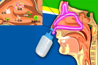 雾化鼻腔冲洗：让宝宝远离呼吸道困扰的有效方法