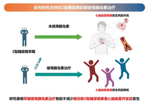 我国科研团队证实2型糖尿病新疗法可有效降低中风与心衰风险