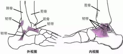 如何正确处理崴脚后，防止留下后遗症