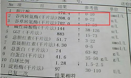 谷丙和谷草转氨酶哪一项升高的严重性更高？