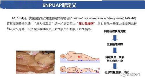 不同的应对压力：自残与创伤修复师Lucy的经历对比