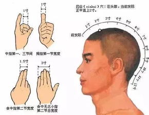 海量脱发相关知识解析：如何科学应对脱发问题