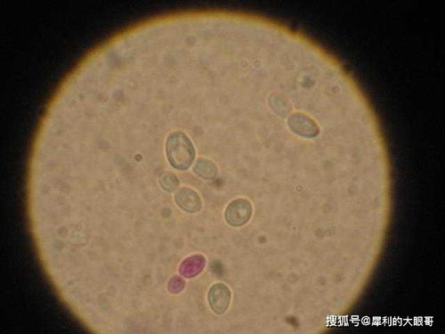 地球上最独特的生命体：没有氧气也能存活的动物