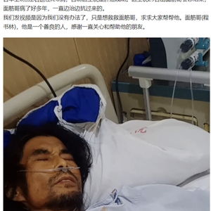 知名网红肝癌晚期进ICU，医院下病危通知！家属求助