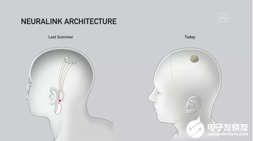 马斯科特·马斯克：成功将第二个患者的脑部植入芯片，400个电极运行良好

马斯克将第二个患者的大脑植入芯片，成功实现电极的大量工作
