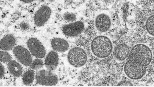 泰国证实首例猴痘病例：66岁欧洲男性，或对全球公共卫生构成威胁