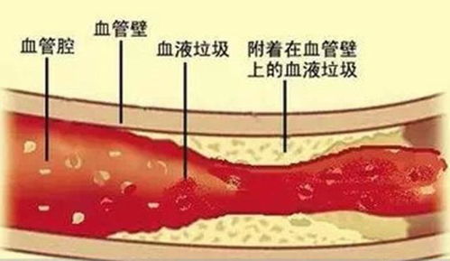 保持身体健康：强力清肠清洁肝脏的‘洗肠草’