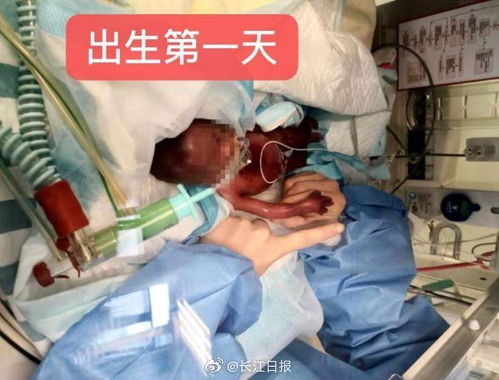 湖北新生儿疑似非正常死亡，当地已成立专班调查处理