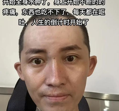 抗癌网红病逝：年仅27岁就面临了生命中最艰难的挑战