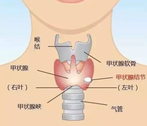 徐若瑄因确诊甲状腺癌需关注甲状腺结节