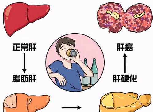 大学生三个月减肥20斤：脂肪肝变重度，又该如何进行有效干预与治疗？