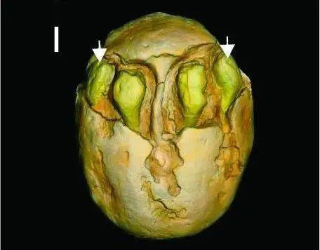 惊世古生物：我们发现了一位孩子正在换牙的远古化石